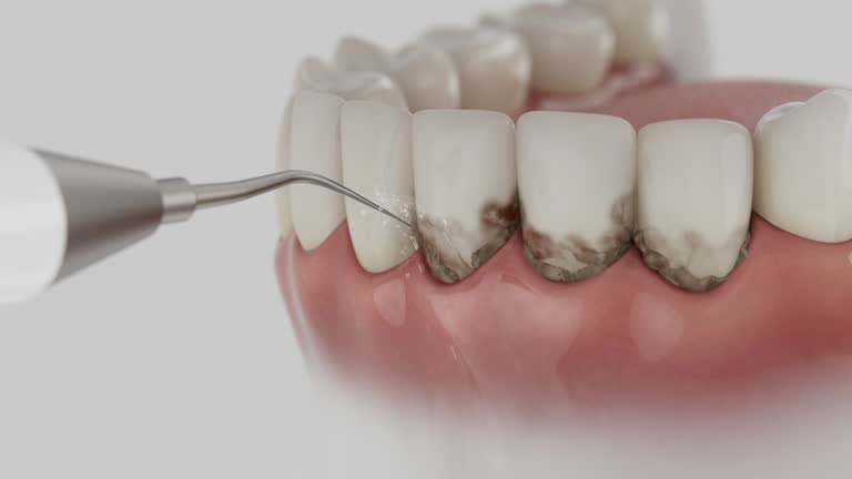 Reliable Tooth Extraction contractor in Hohenwald, TN by Smile Center Dentistry